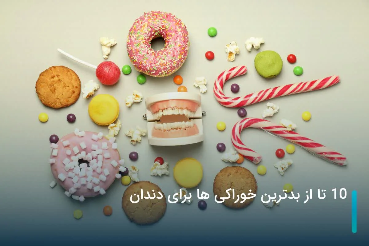 10 تا از بدترین خوراکی ها برای دندان