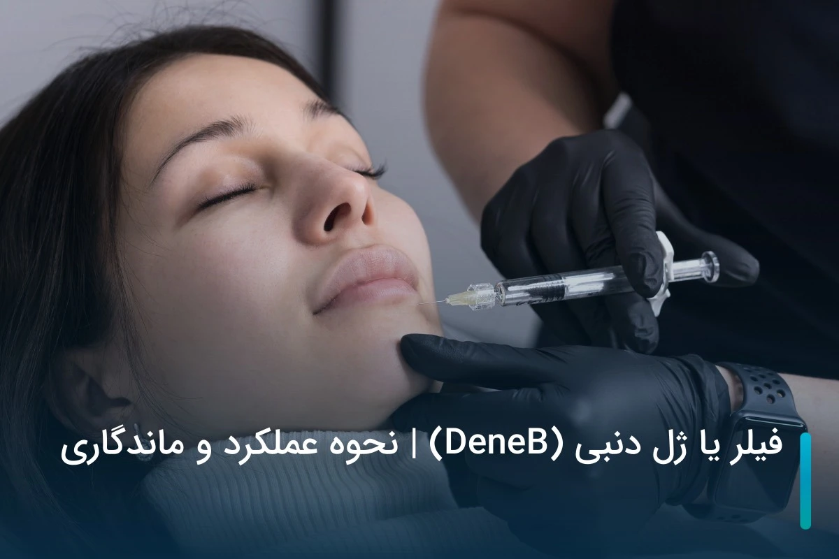 فیلر یا ژل دنبی (DeneB) | نحوه عملکرد و ماندگاری