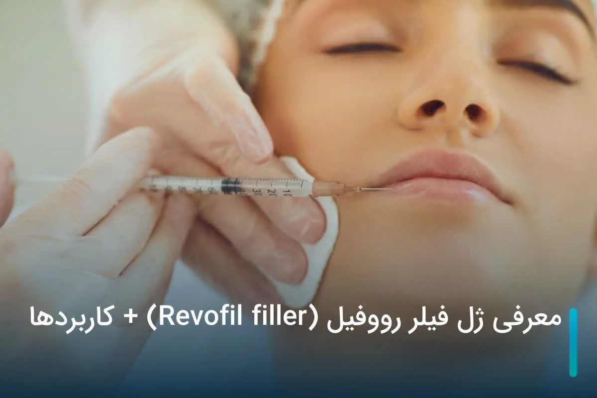 معرفی ژل رووفیل (Revofil filler) + کاربردها