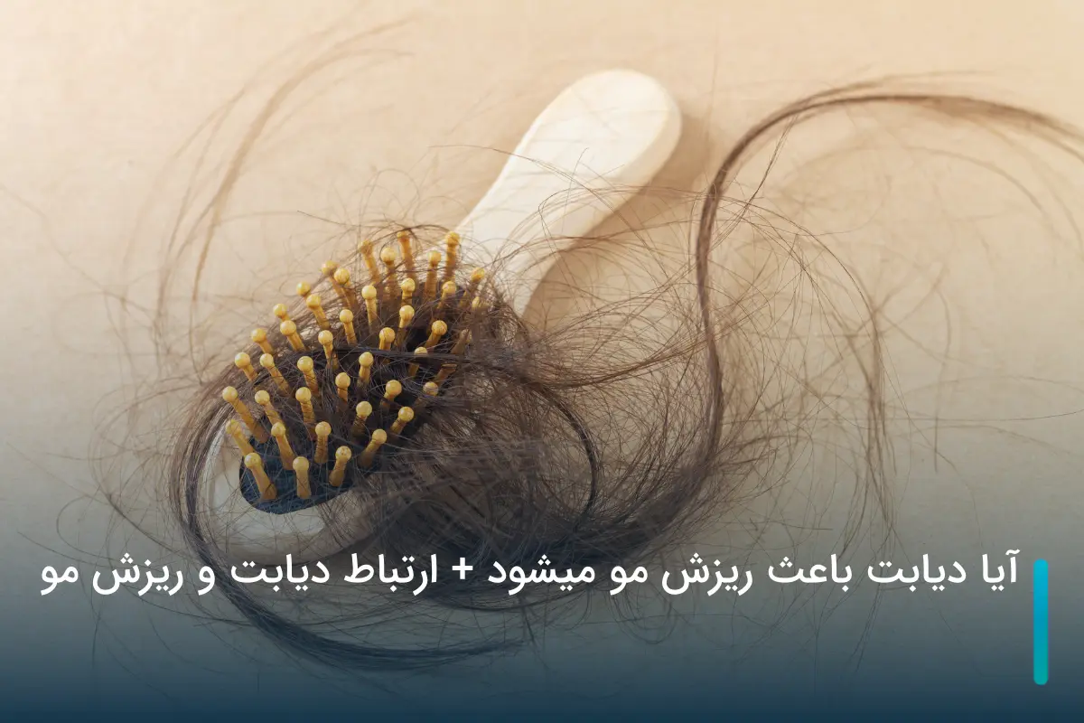 آیا دیابت باعث ریزش مو میشود + ارتباط دیابت و ریزش مو
