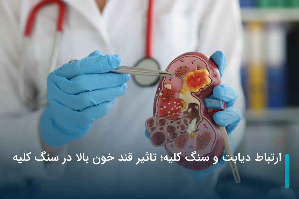 ارتباط دیابت و سنگ کلیه؛ تاثیر قند خون بالا در سنگ کلیه
