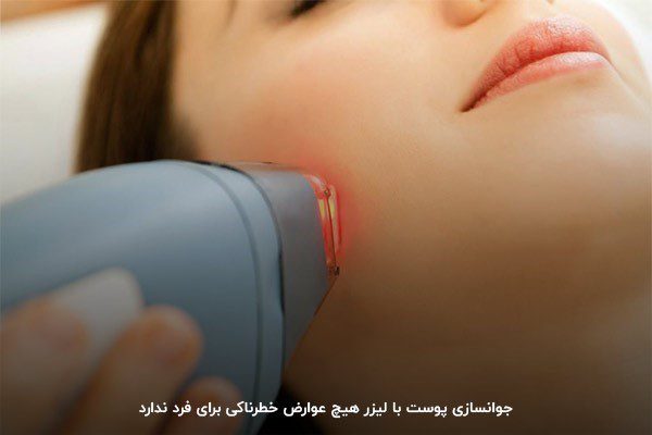Laser skin rejuvenation