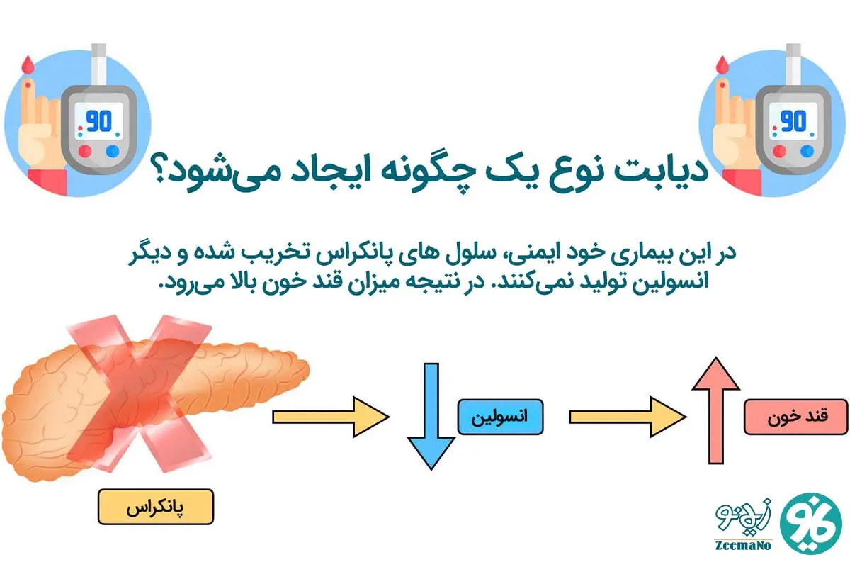 دیابت نوع یک چگونه ایجاد میشود؟