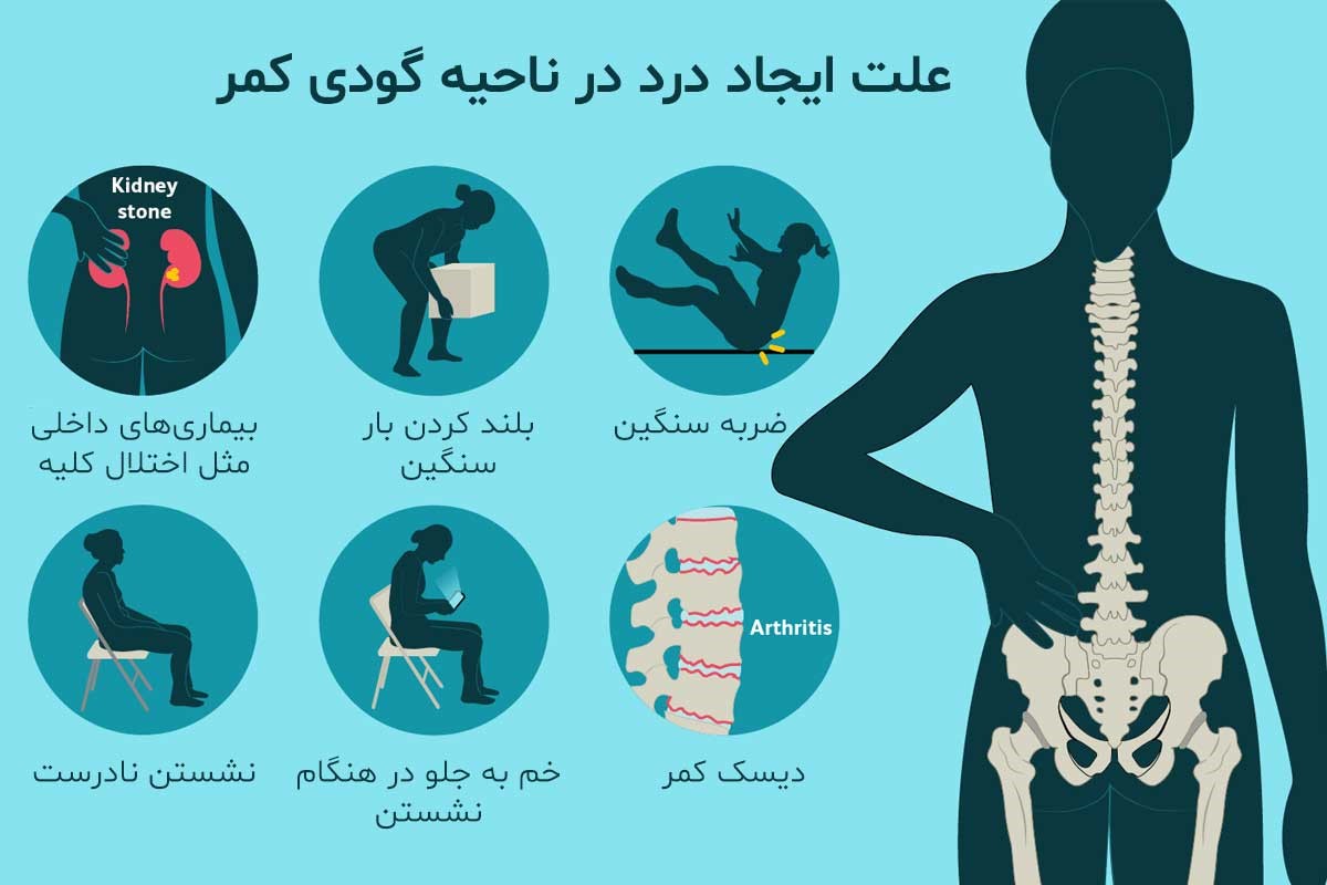 lordosis 2