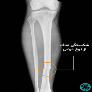 ارتوپدی