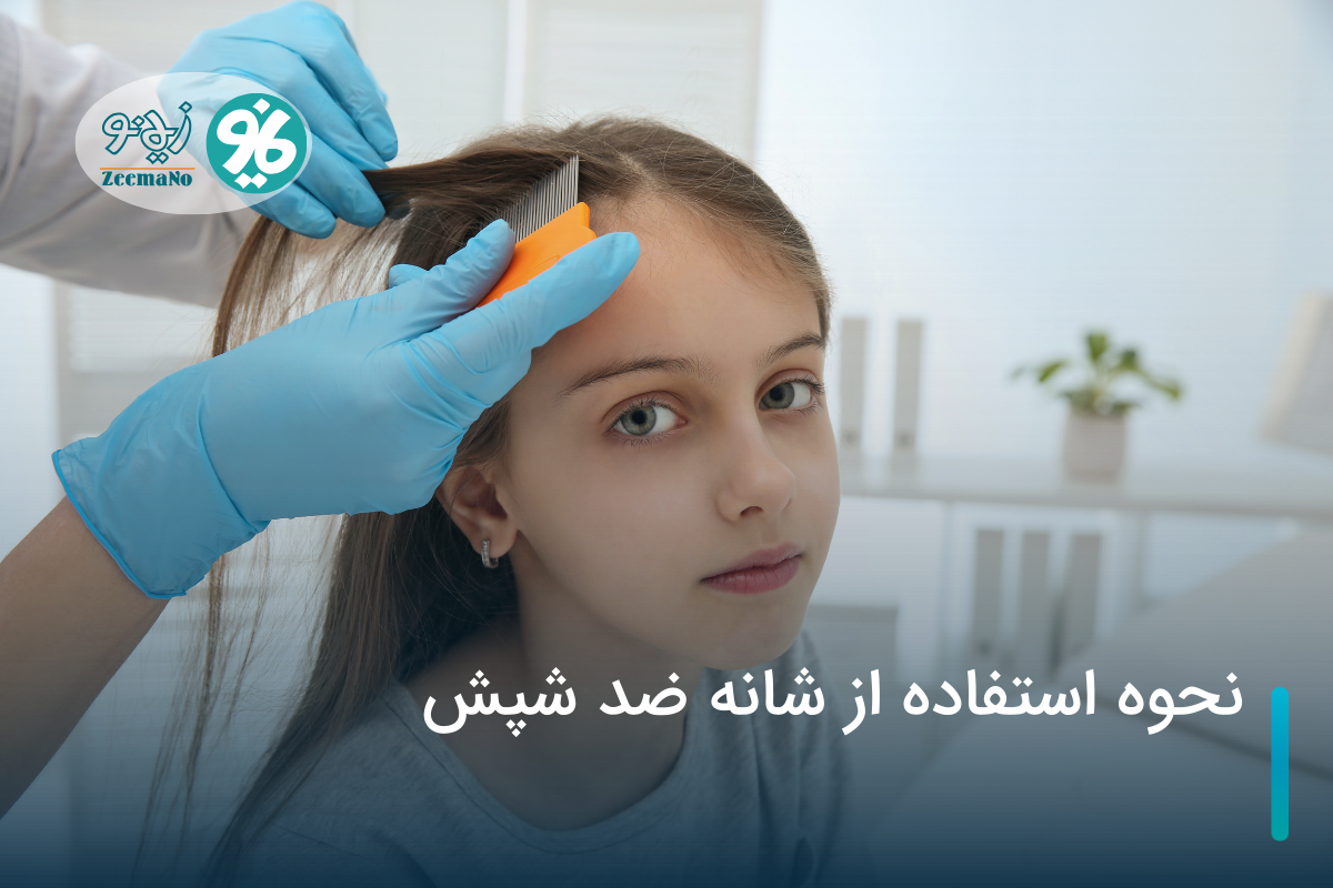 شانه ضد شپش و نحوه استفاده از آن