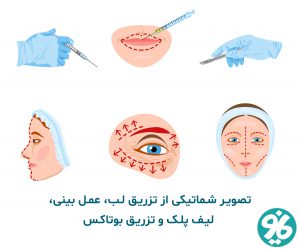 جراحی زیبایی ترمیمی