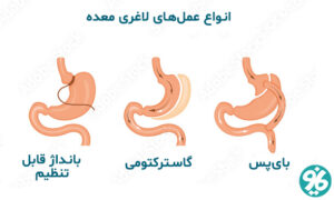 کاهش وزن