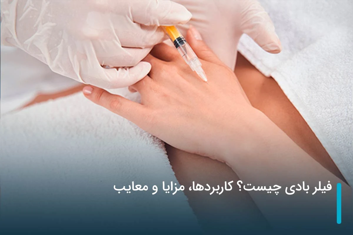 فیلر بادی چیست؟ کاربردها، مزایا و معایب