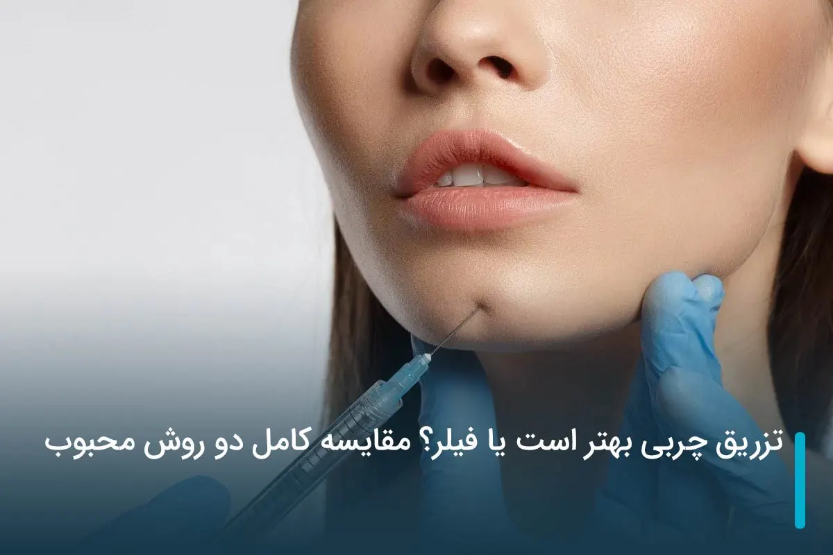 تزریق چربی بهتر است یا فیلر؟ مقایسه کامل دو روش محبوب
