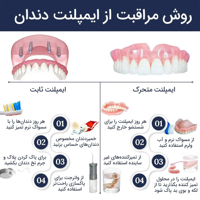 مراقبت های ایمپلنت دندان